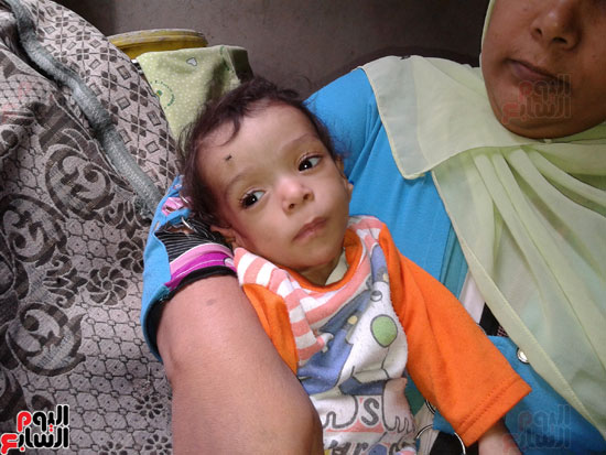 الطفل أحمد مصاب بضمور فى المخ وكهربا
