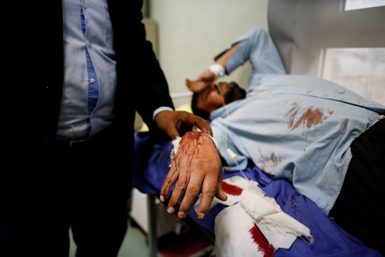 أحد-الجرحى-يتلقى-العلاج-فى-مستشفى-بعد-هجوم-اربيل---الموصل-،-بالعراق-رويترز