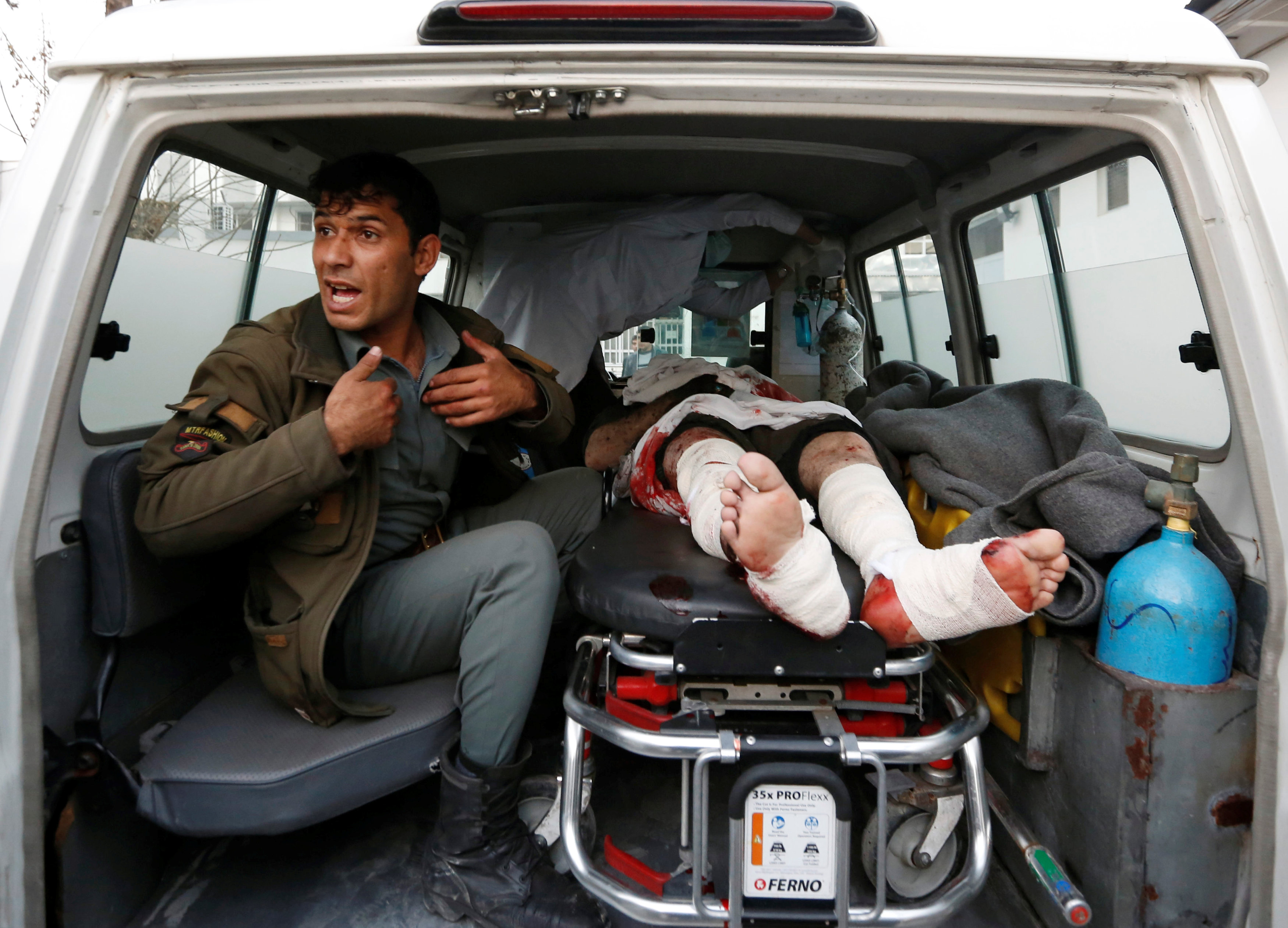 أحد مصابى التفجير الارهابى قرب البرلمان الأفغانى فى العاصمة كابول