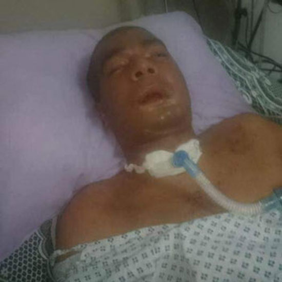  الرائد مصطفى يسرى عانى 3 سنوات بسبب إصابته أثناء أداء الواجب