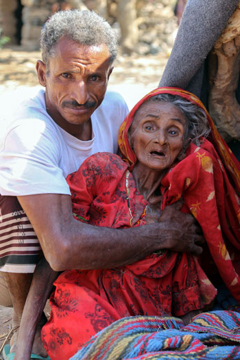 سيدة فى تعز اليمنية وآثار المجاعة ظاهرة عليها