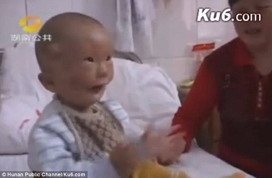 الطفل الصيني وقت الاستشفاء بعد العملية