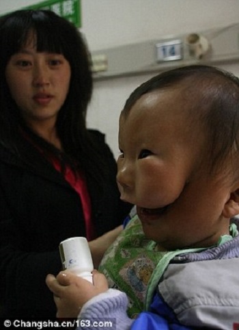 جانب من وجه الطفل الصيني هويكانج