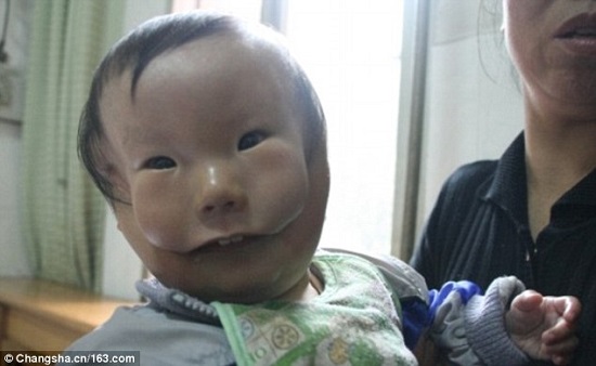 الطفل الصيني الذي أطلق عليه اسم - الصبى ذو الوجهين-