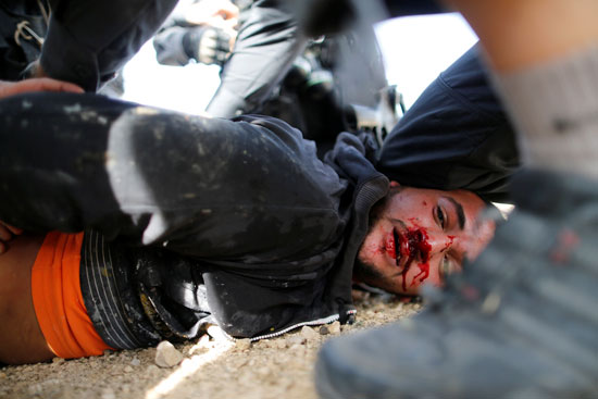 	رجل فلسطينى مصاب فى الاشتباكات مع القوات الإسرائيلية بأم الحيران