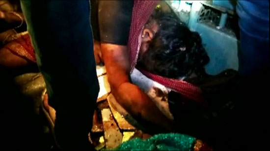 أحد المصابين بعد خروج قطار عن القضبان فى الهند