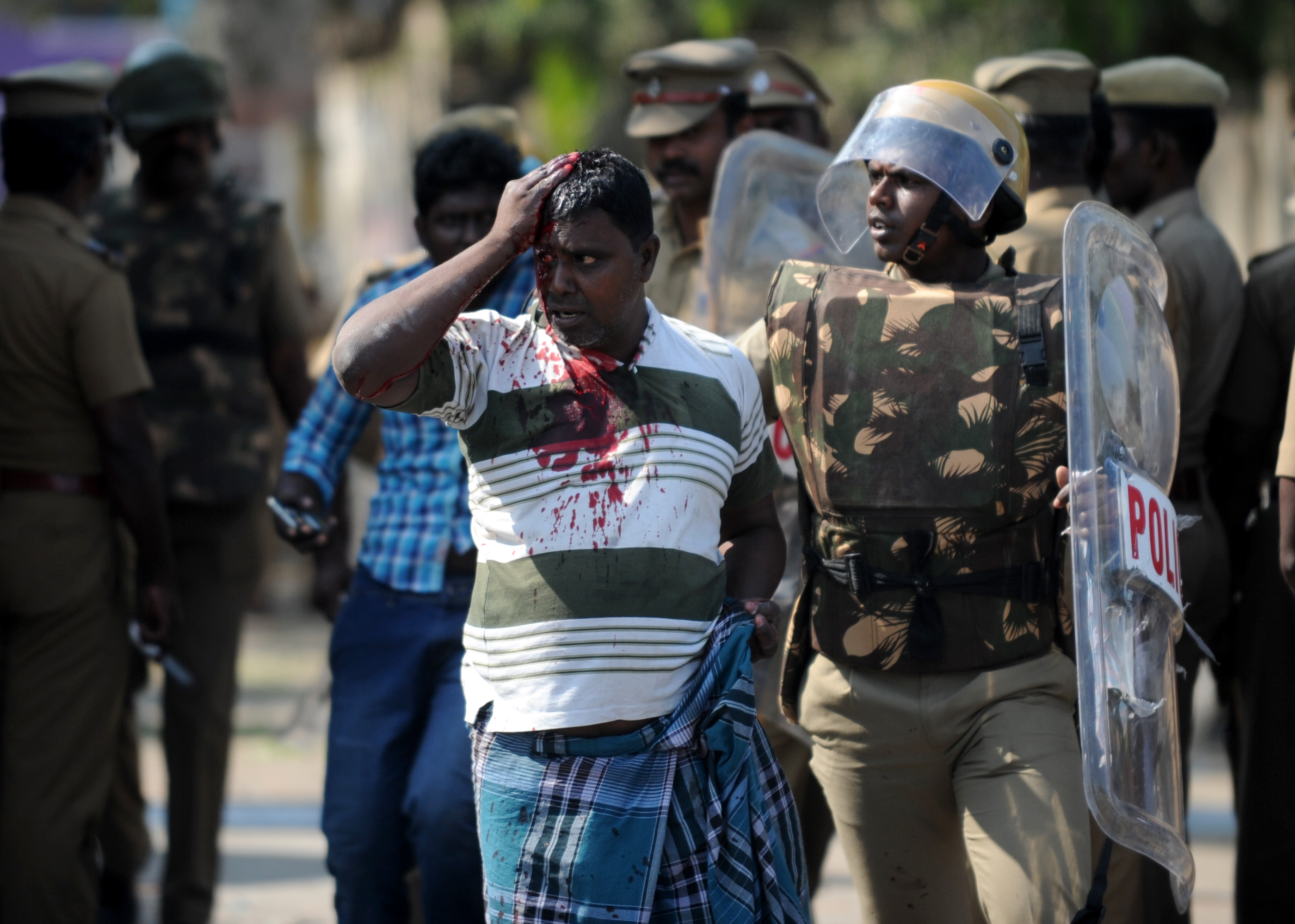 متظاهر ينزف رأسه خلال اشتباكات مع الشرطة الهندية