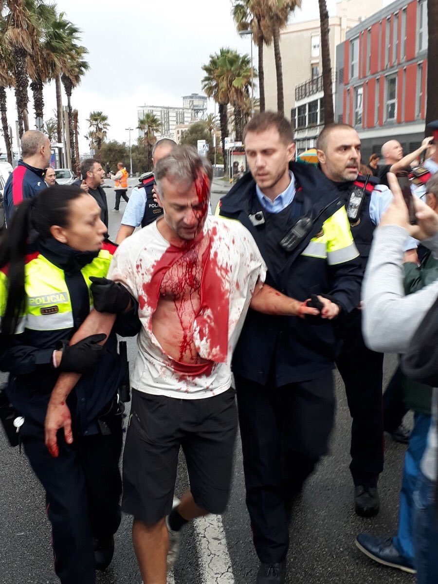 أحد المصابين فى مدينة برشلونة بعد إشتباكات مع الأمن الأسبانى