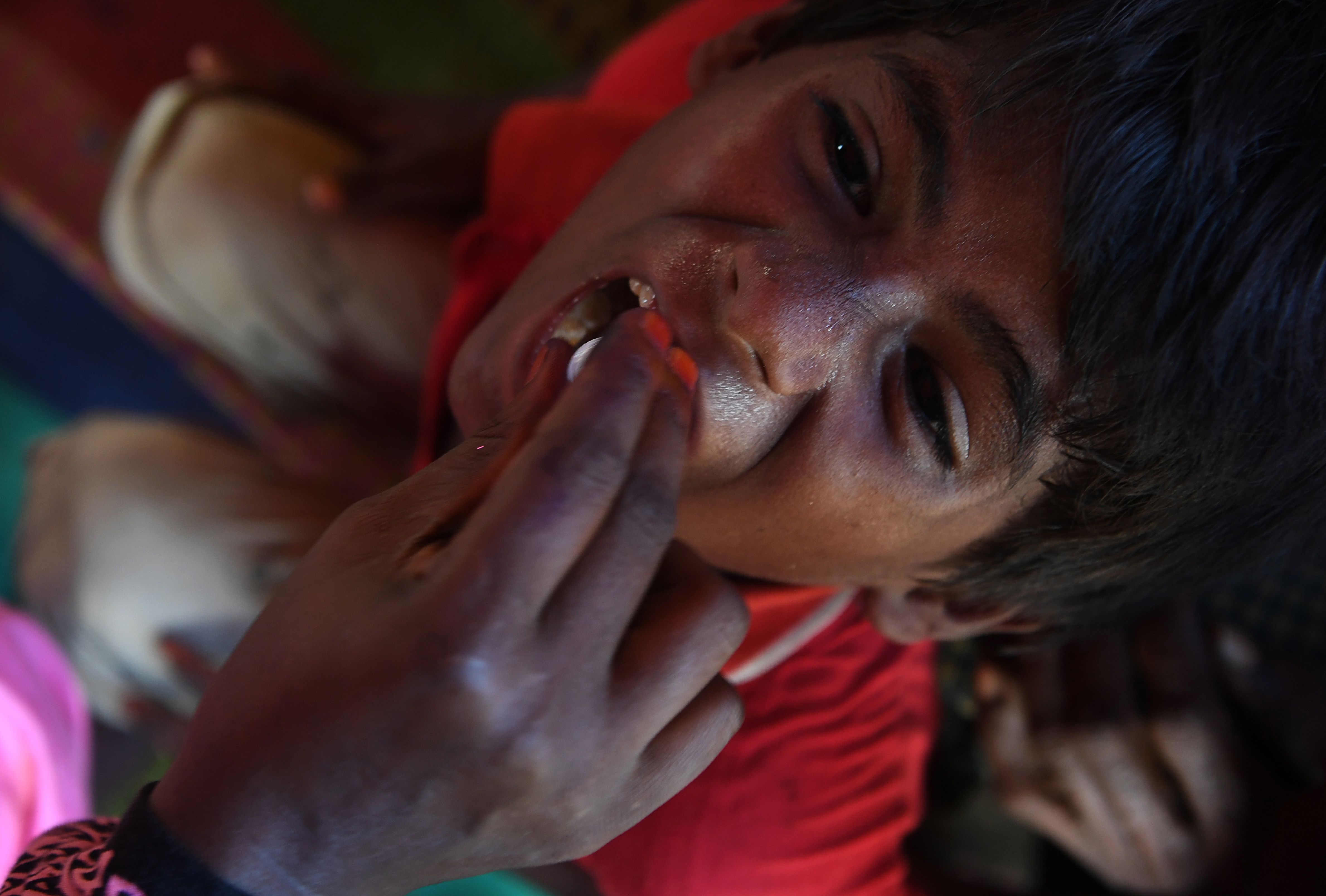 تطعيم طفلة من الروهينجا