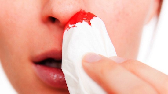 Nose-bleeding