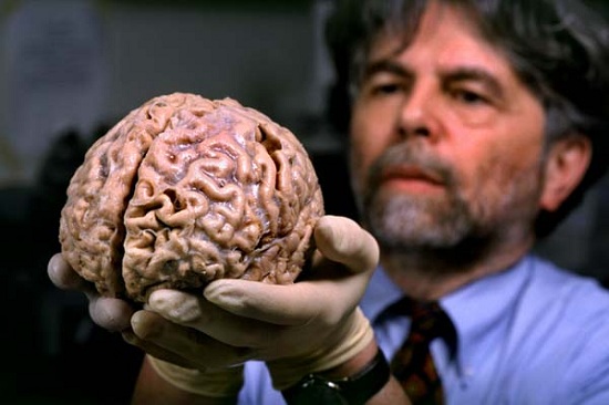 human-brain