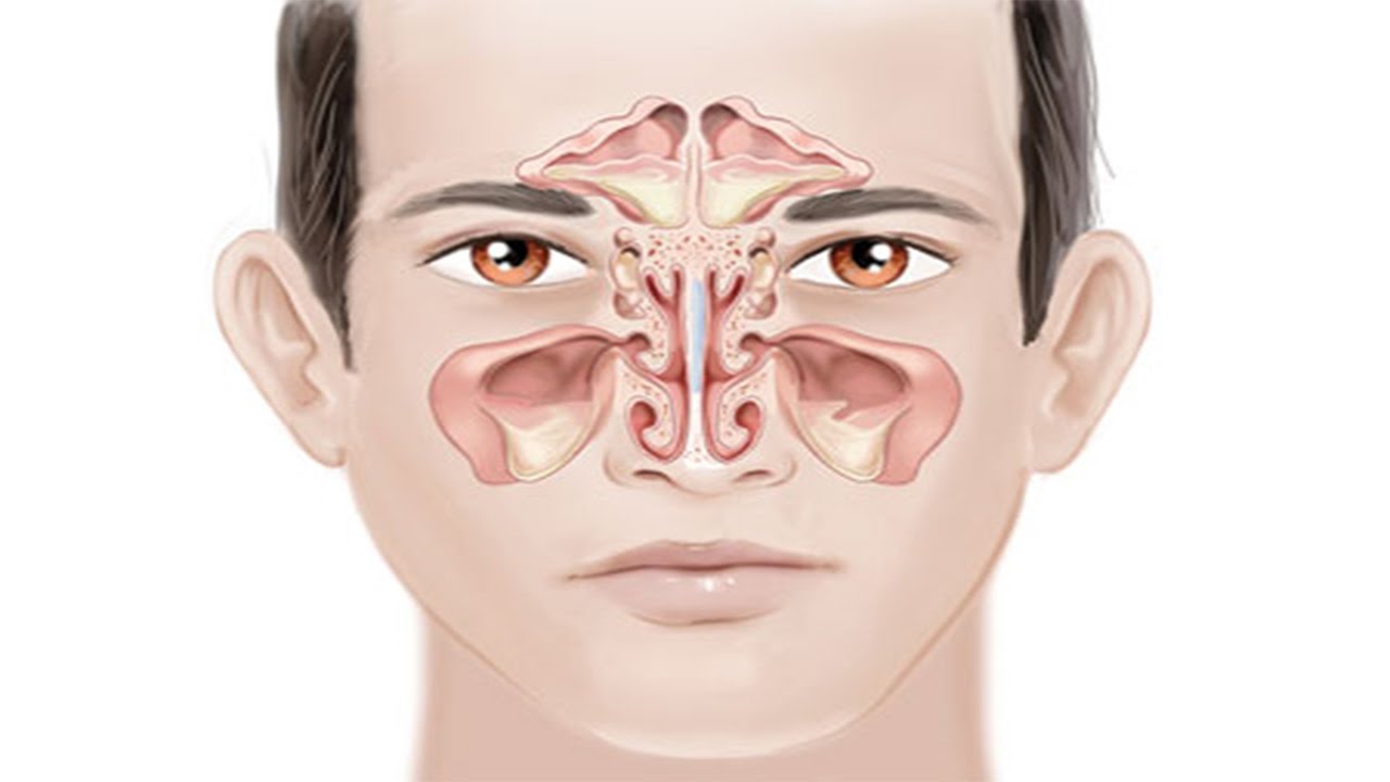 جيوب الانفية