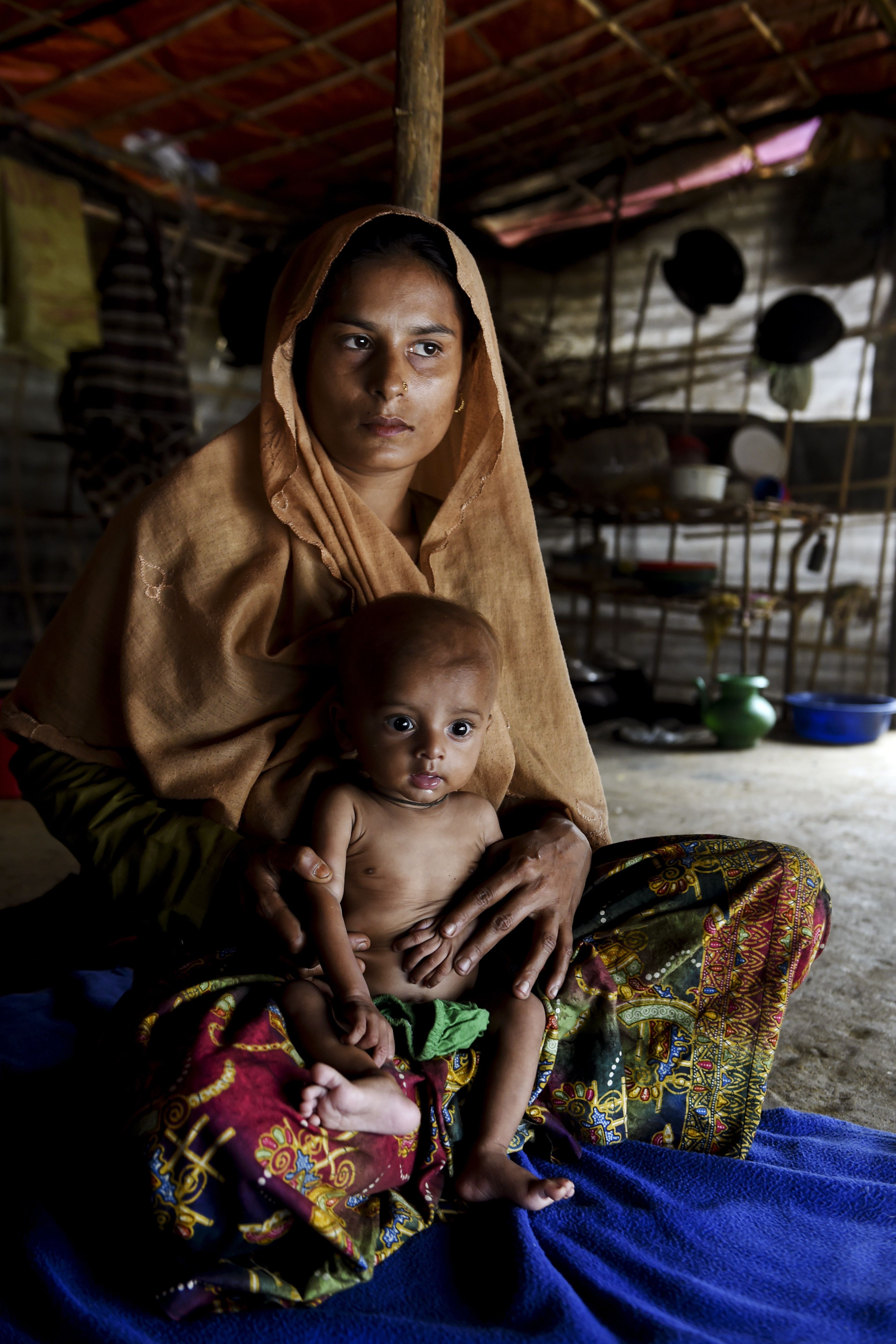 سيدة تحمل طفلها الذى يعانى من سوء التغذية