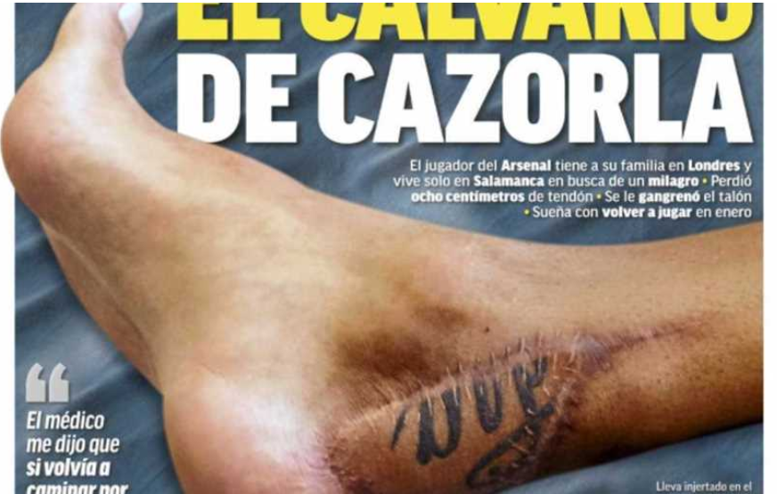 قدم كازورلا لاعب وسط ارسنال بعد الجراحة الماضية