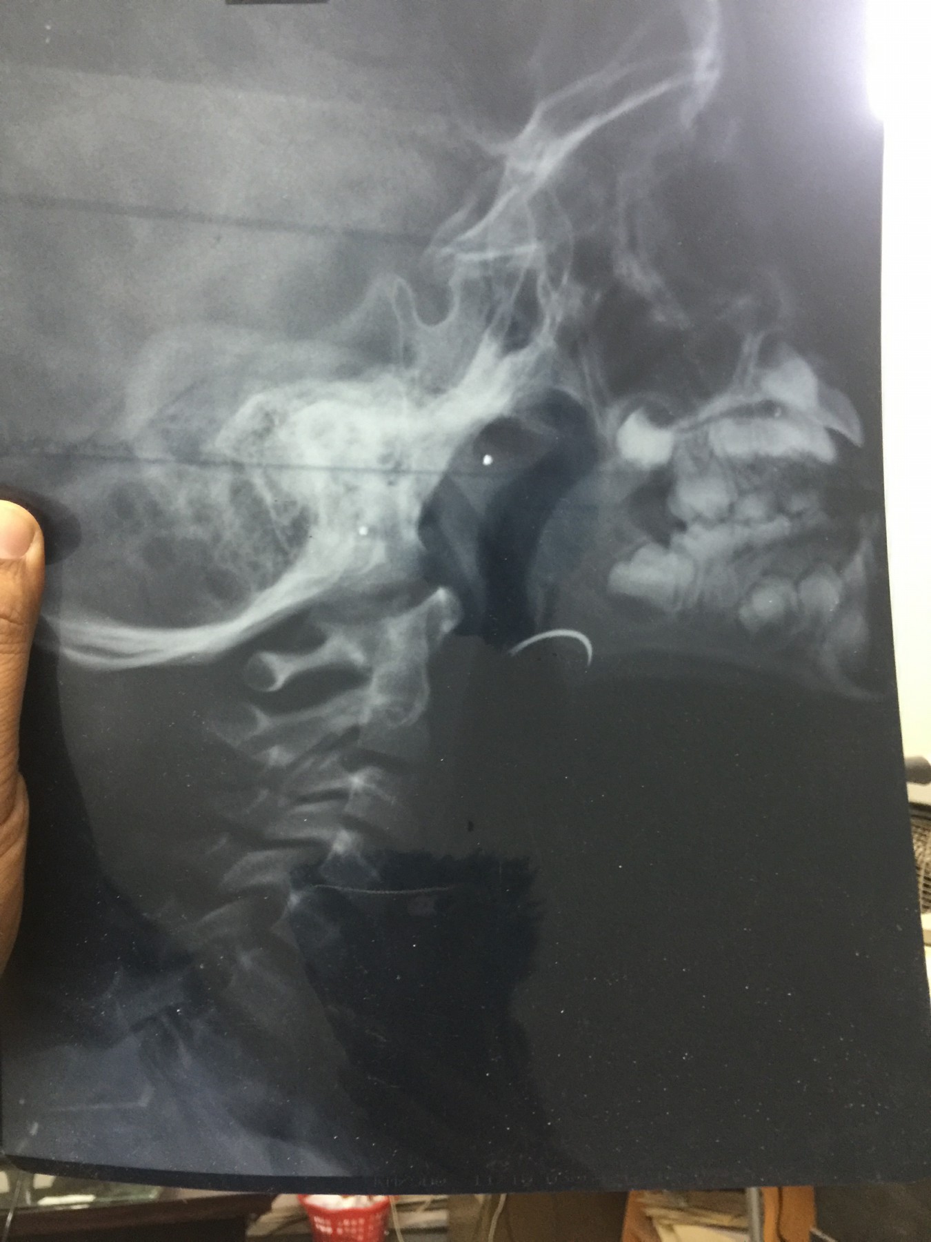 ابره فى زور طفل (8)