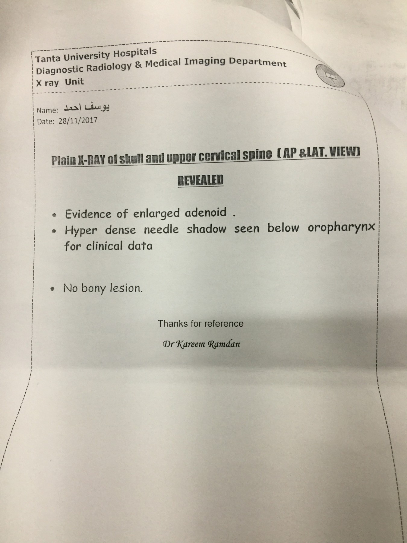 ابره فى زور طفل (7)