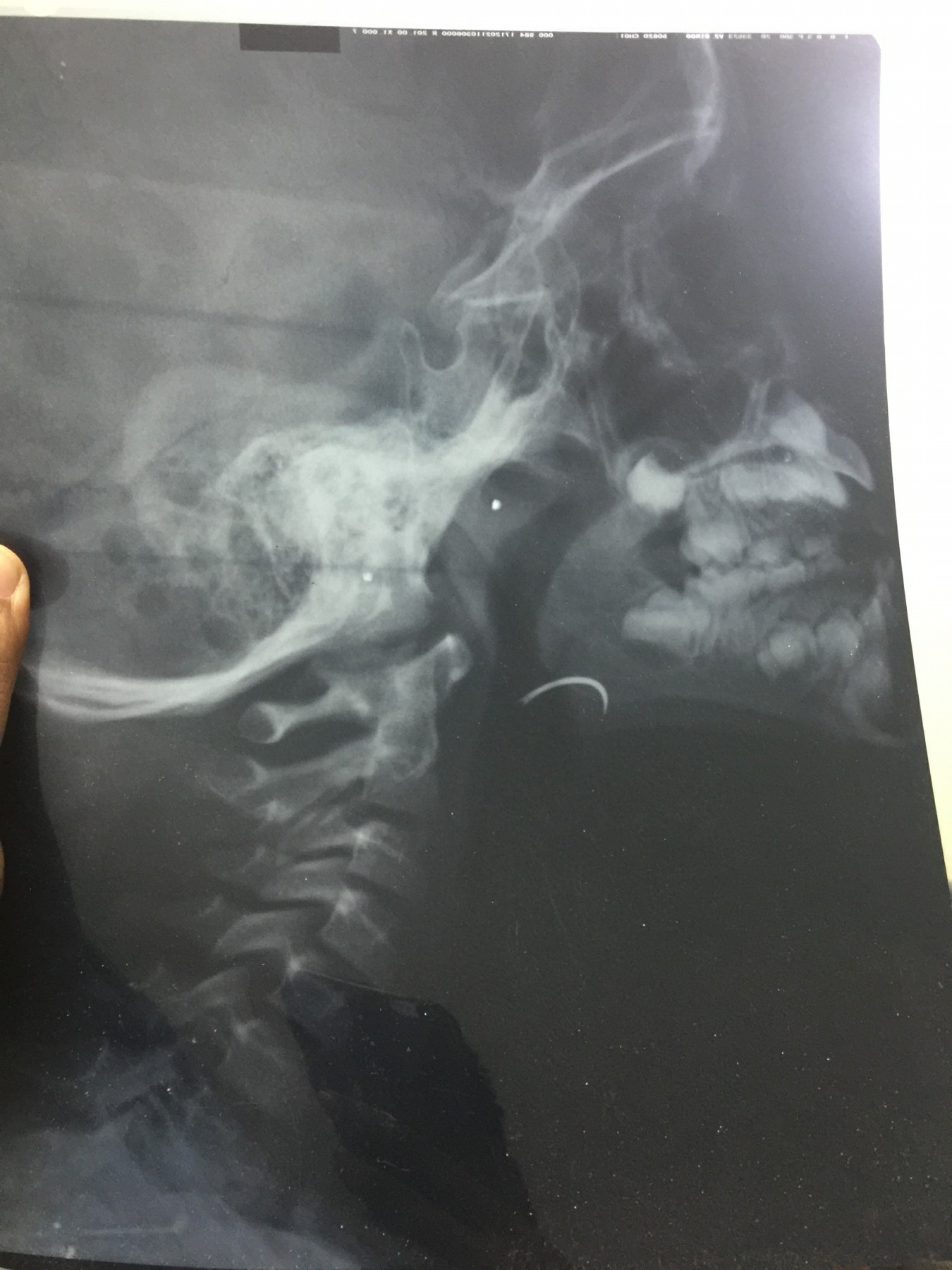 ابره فى زور طفل (11)