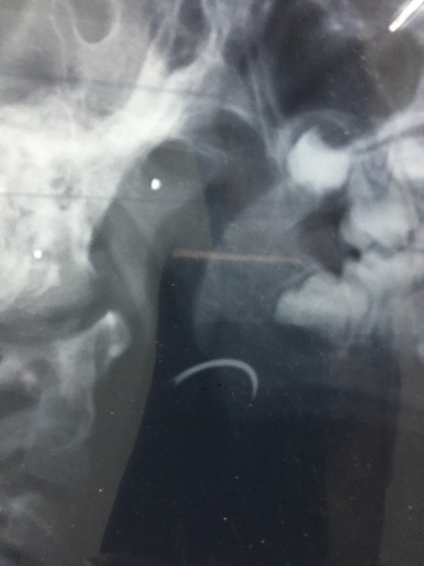 ابره فى زور طفل (10)