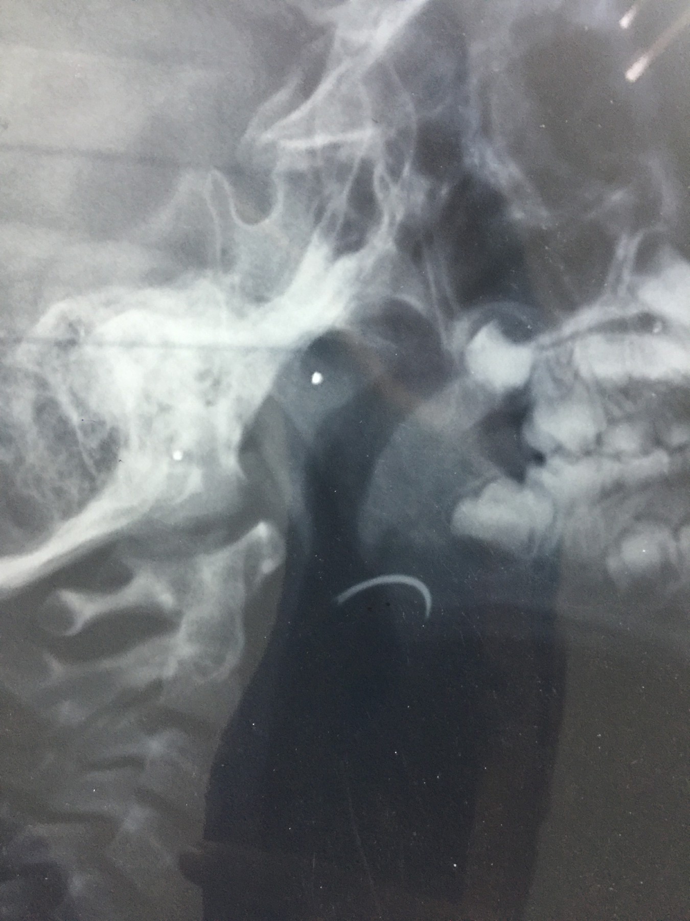 ابره فى زور طفل (9)