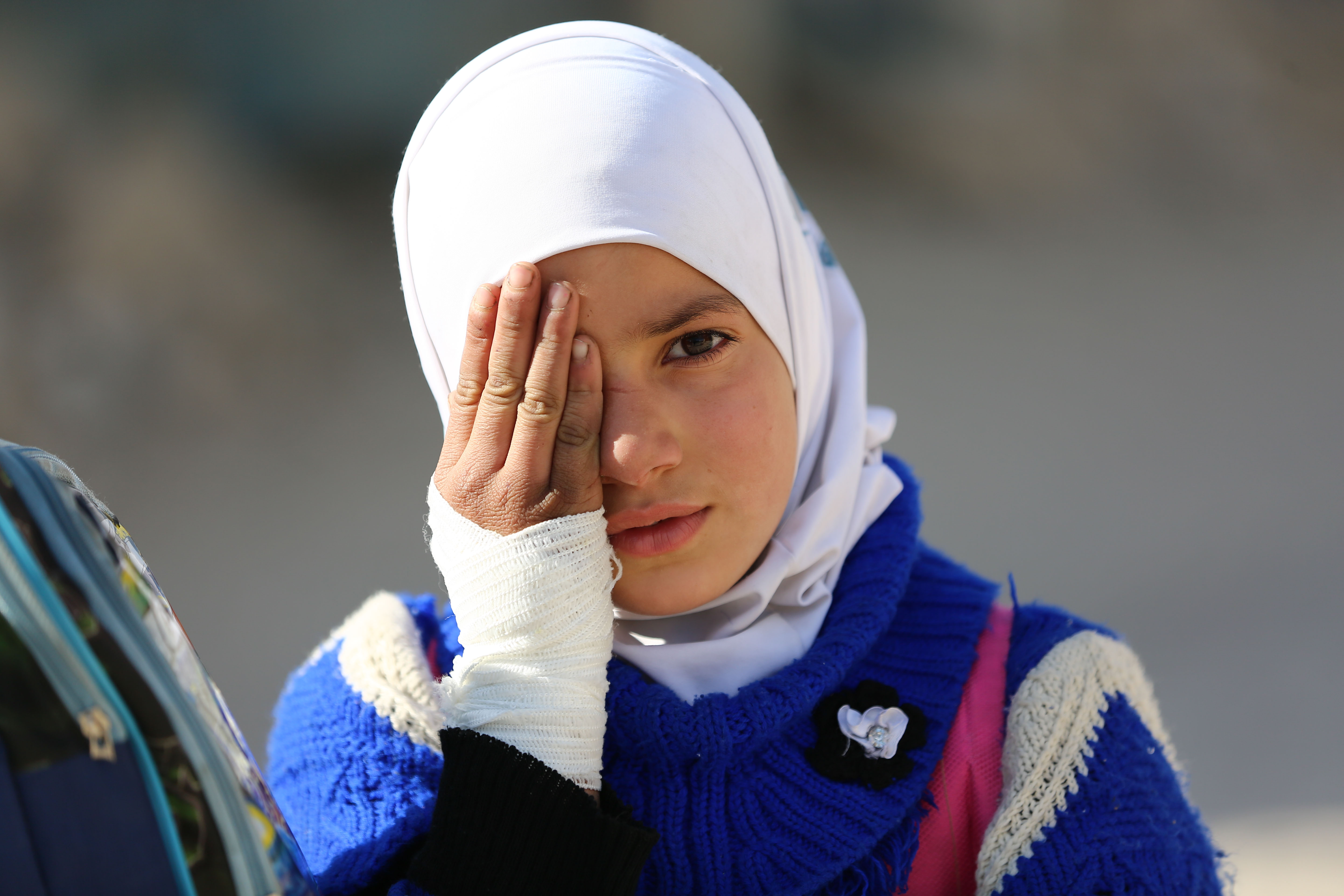 طفلة سورية تتضامن مع طفل فقد عينه