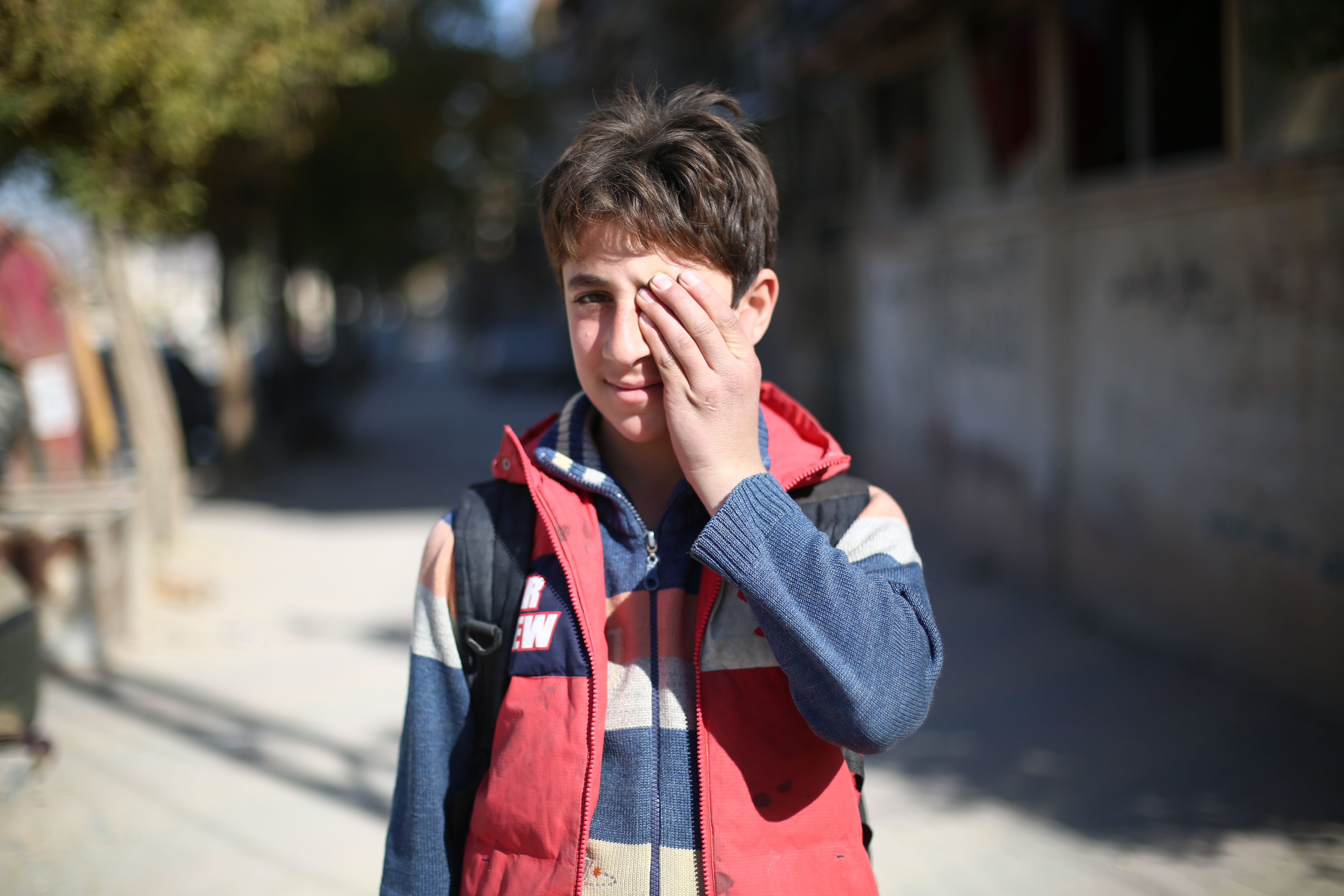 طفل سورى يتضامن مع طفل فقد عينه