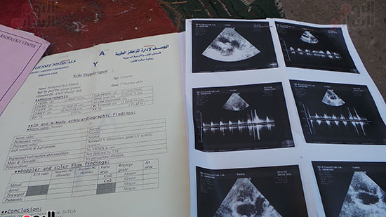 8 الأشعة الخاصة بالطفل محمد ويحتاج إلى عملية قلب مفتوح