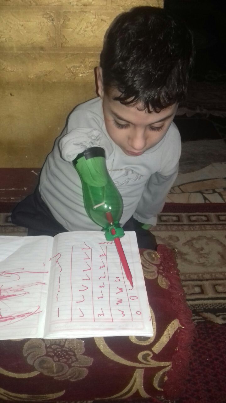 الطفل زياد يكتب بعد تركيب زجاجة كأطراف صناعية