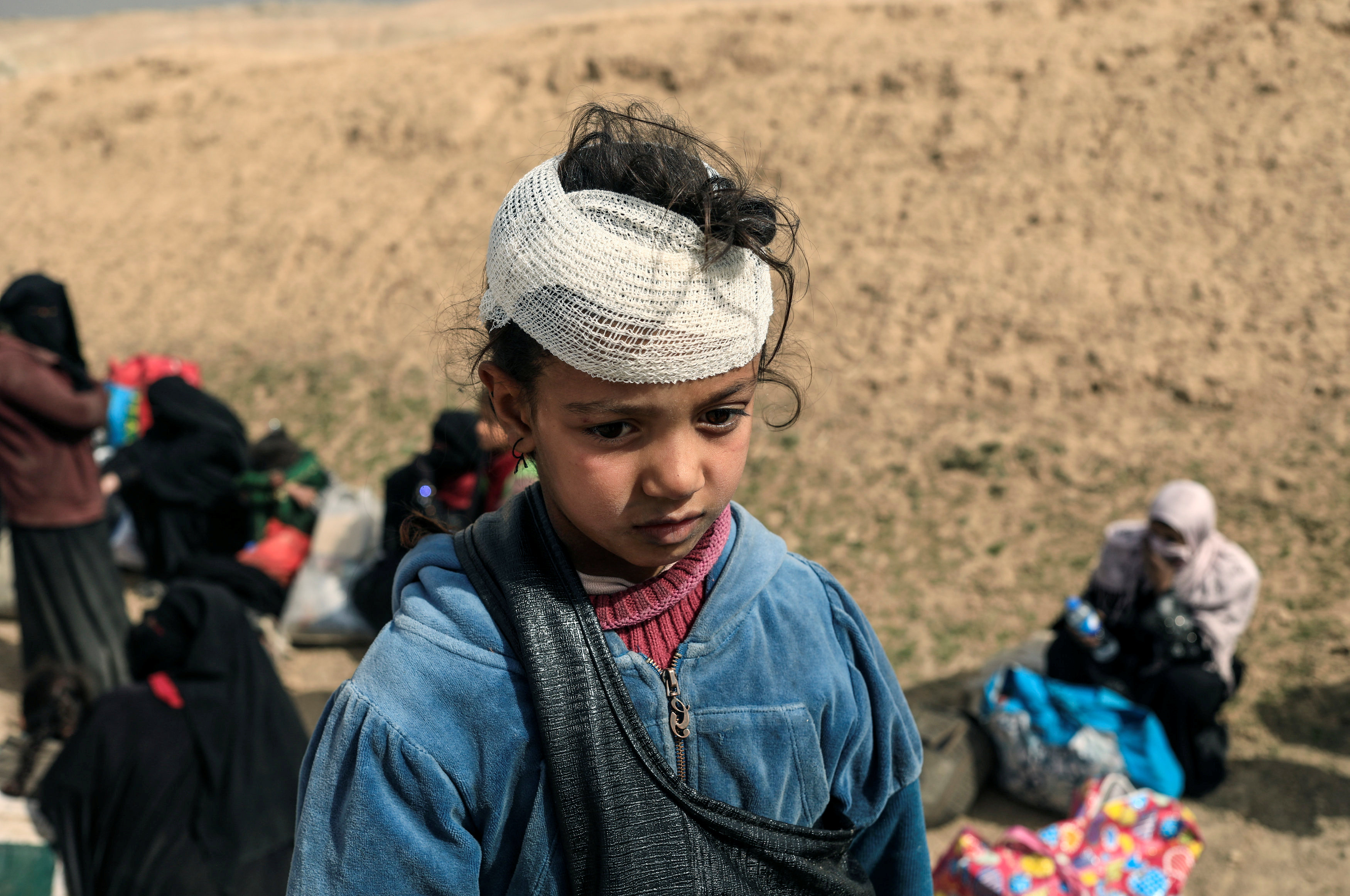 طفلة عراقية مصابة فى رأسها داخل قاعدة عسكرية للجيش