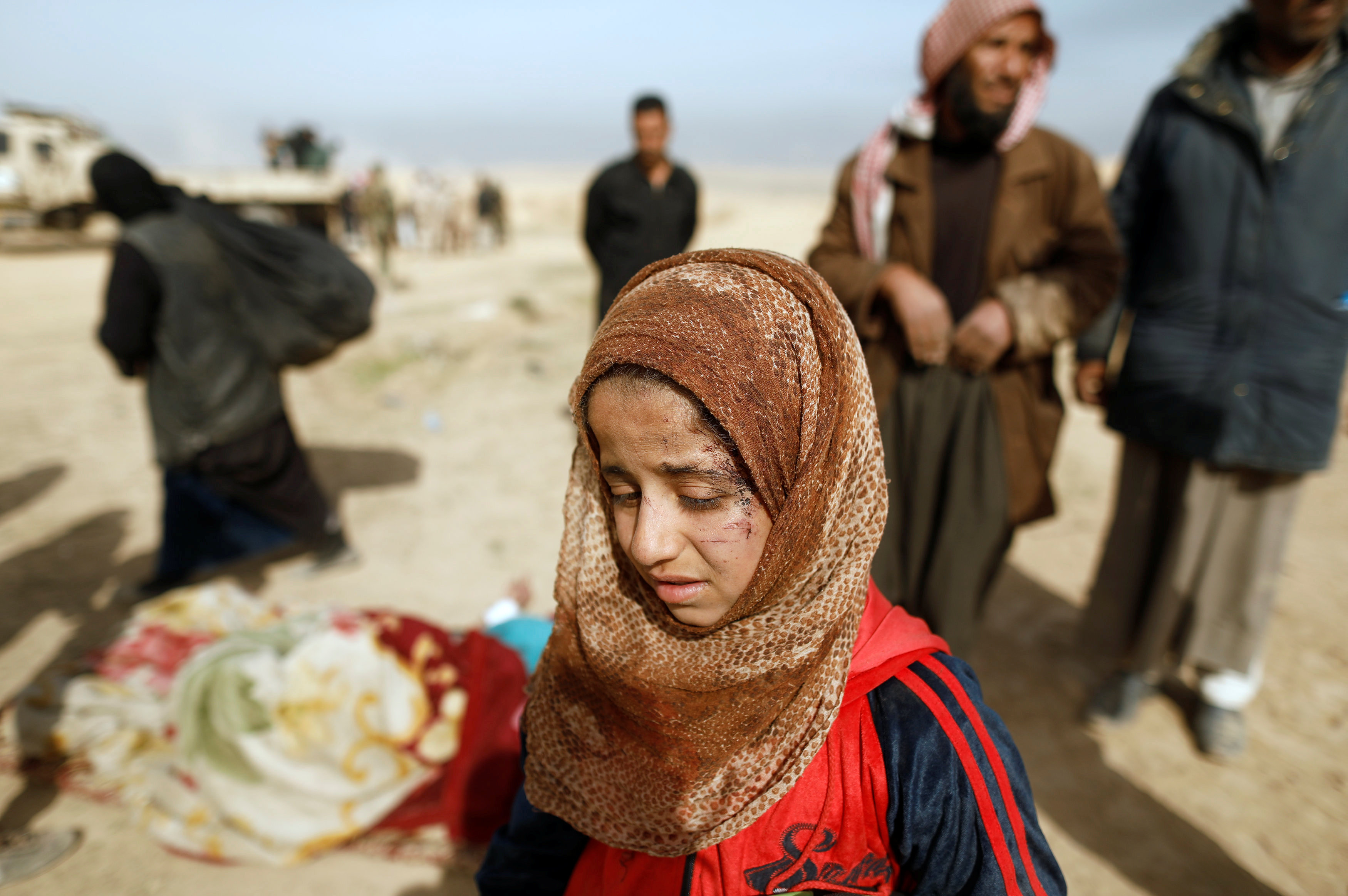 طفلة عراقية مصابة فى وجهها تصل قاعدة القوات الخاصة بعد هروبها من داعش