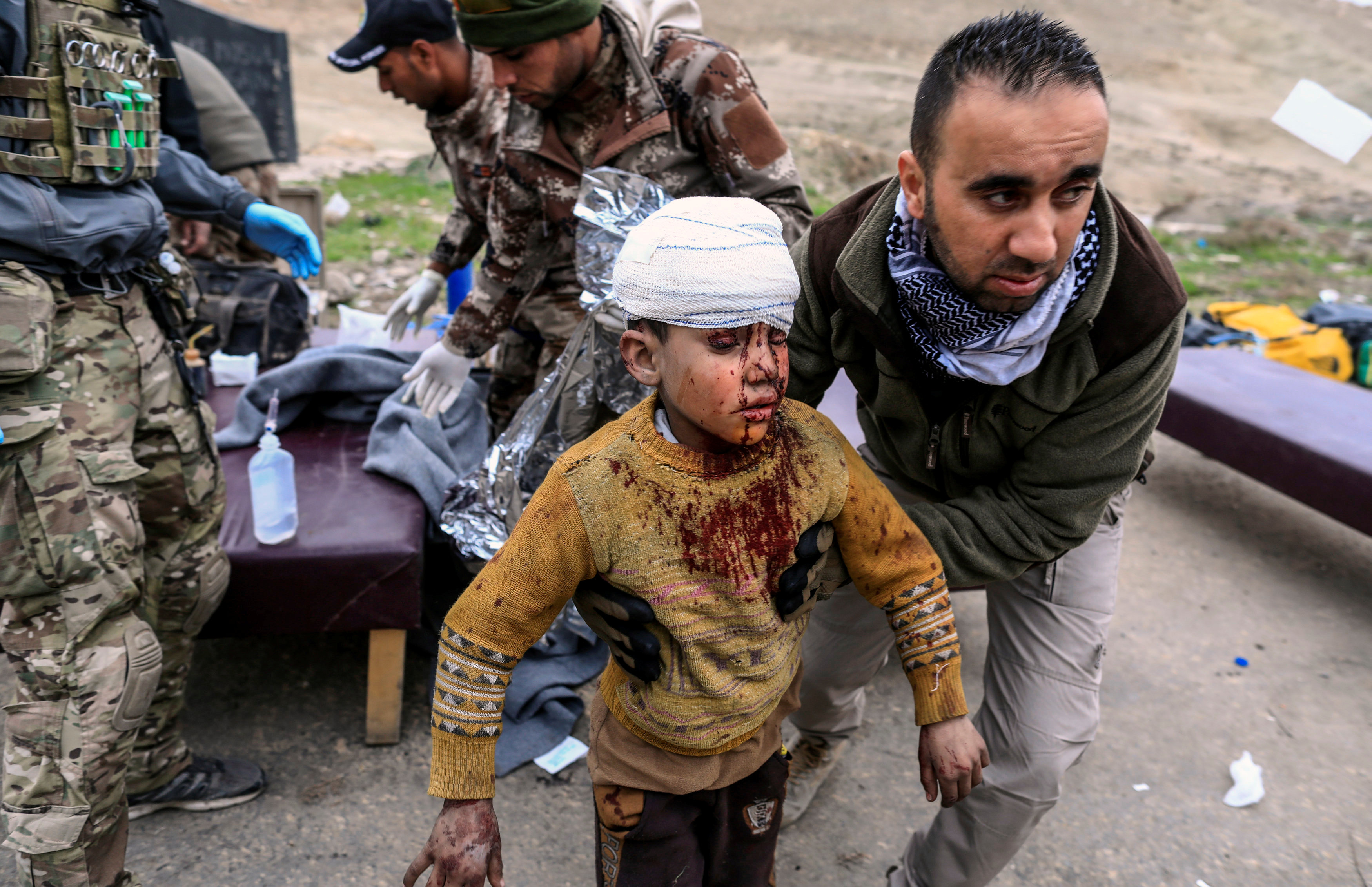 طفل مصاب فى اشتباكات الموصل