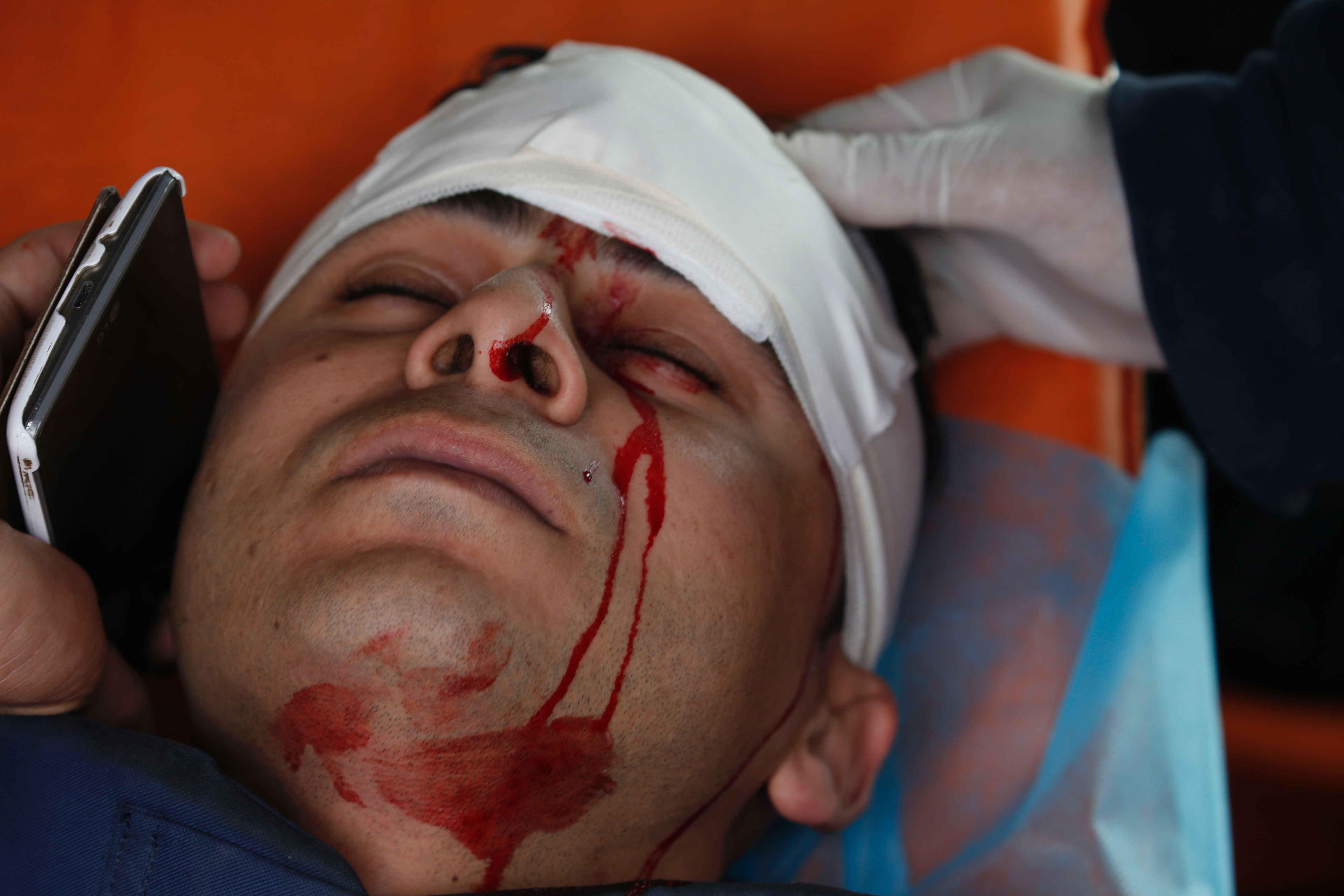مراسل التلفزيون الفلسطيني يتحدث على الهاتف بينما كان يتلقى العلاج مراسل التلفزيون الفلسطيني يتحدث على الهاتف بينما كان يتلقى العلاج
