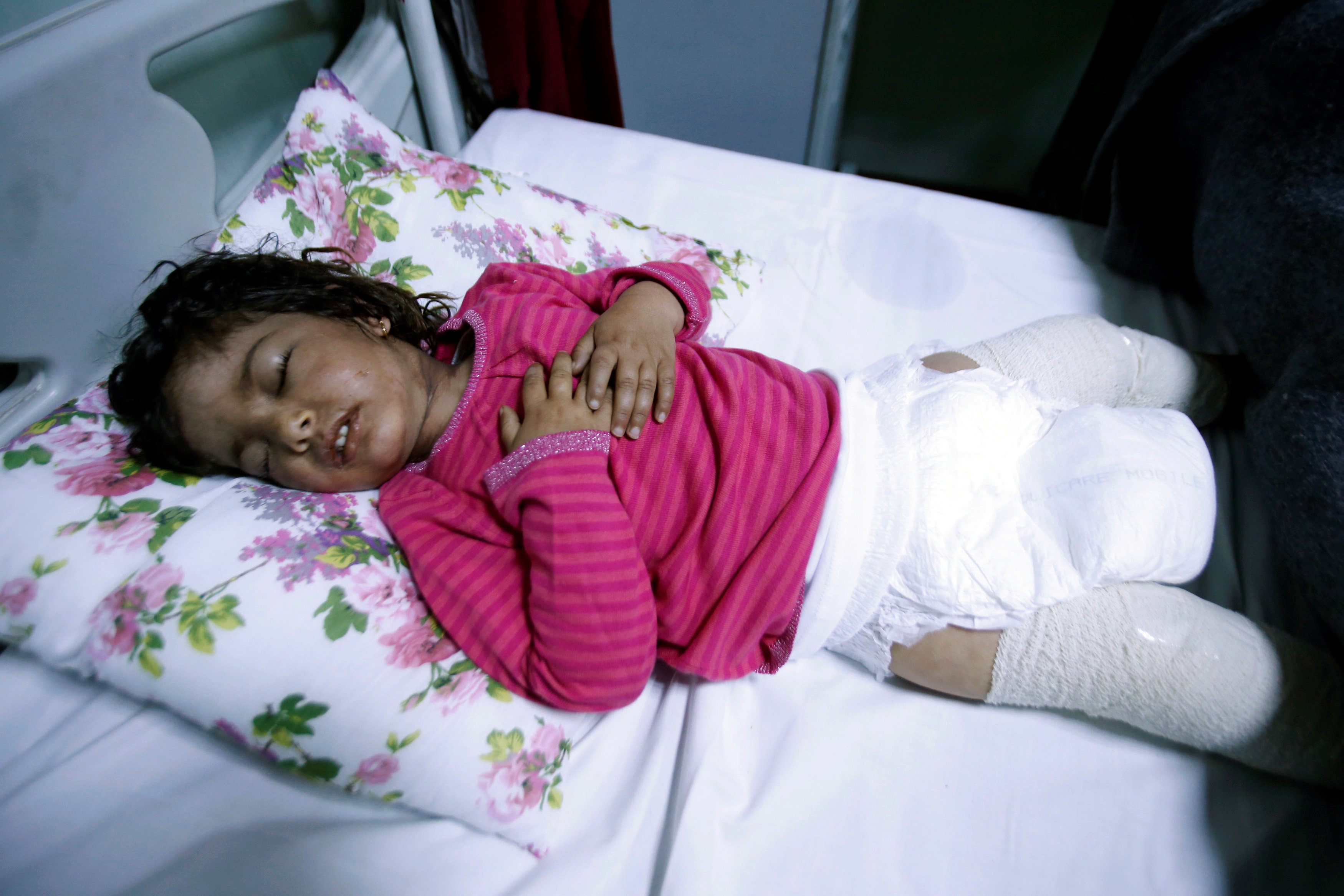 طفلة مصابة فى أحداث الموصل