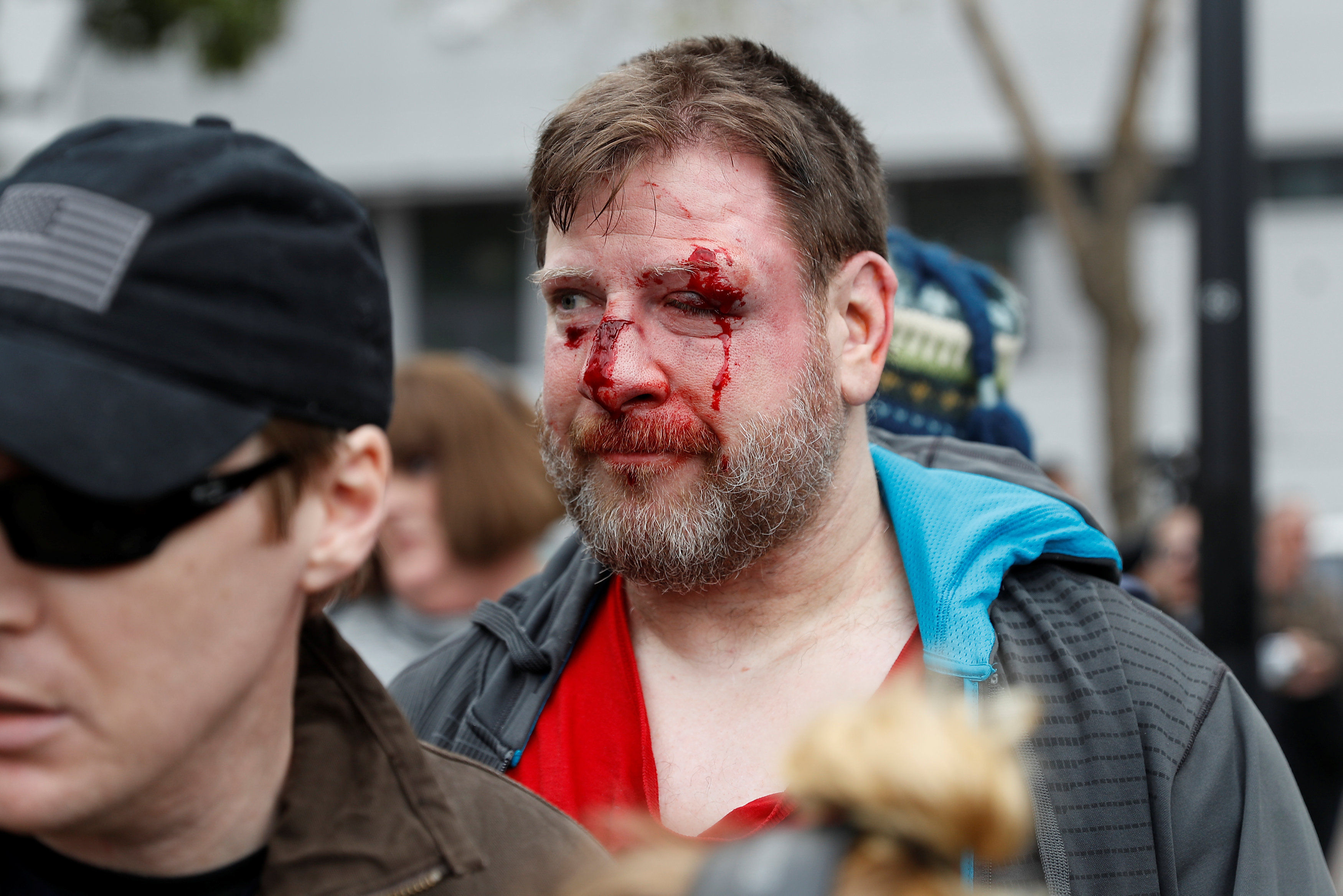إصابة أحد المتظاهرين عقب الاعتداء عليه من مؤيدى ترامب