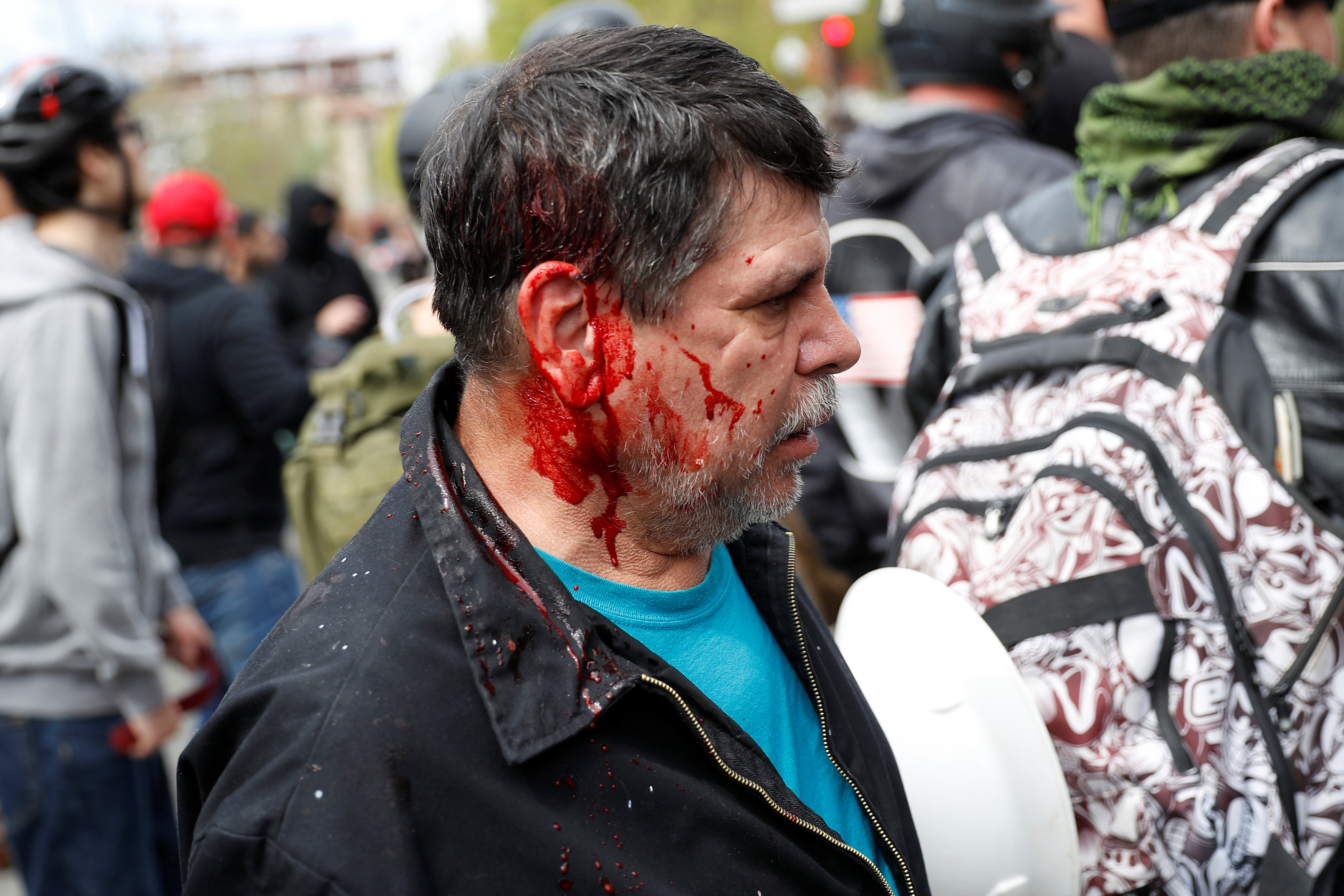أحد الأمريكيين أصيب فى رأسه خلال أعمال العنف التى واكبت الاحتجاجات
