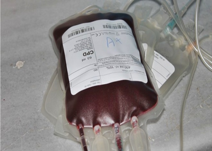 أكياس دم (1)