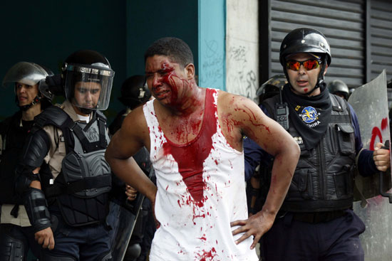إصابة أحد المحتجين خلال الاشتباكات