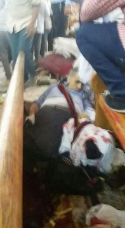 ننشر صور المصابين فى حادث انفجار كنيسة مارى جرجس بطنطا (7)