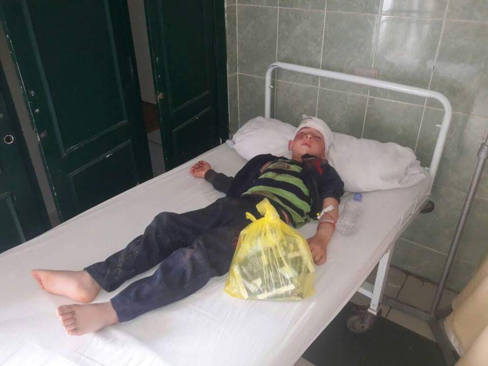 أحد الأطفال السوريين المصابين