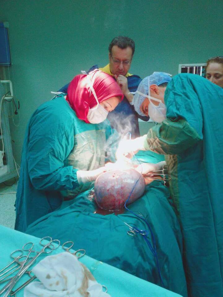 الأطباء خلال عملية إزالة الورم من السيدة
