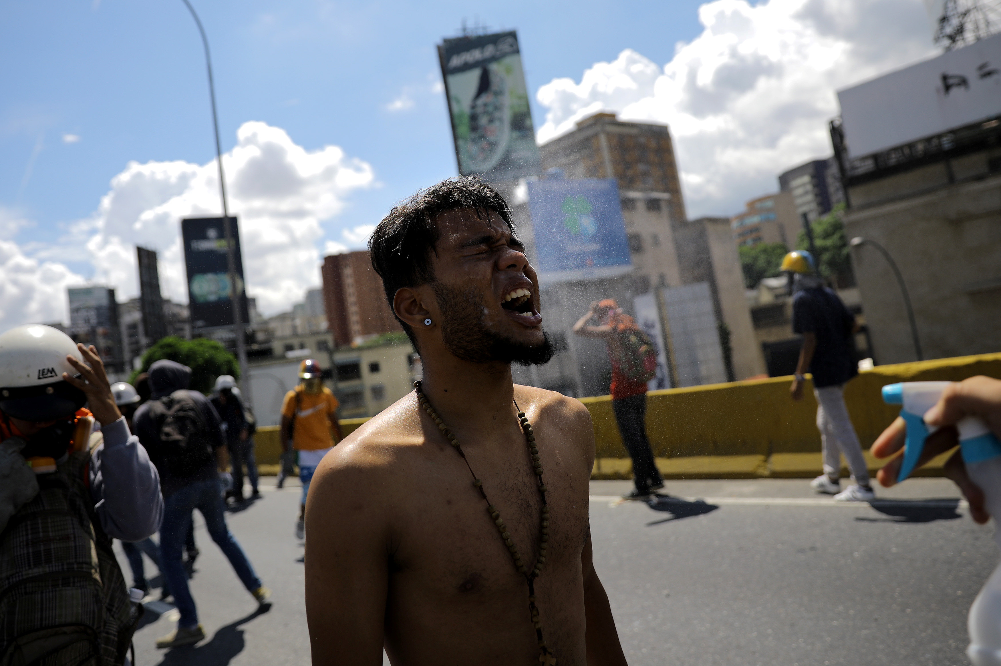 أحد المتظاهرين الفنزويلين