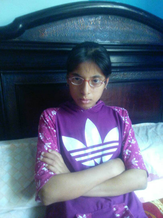 طفلة عمرها 10 سنوات معرضة للإصابة بشلل رباعى (8)
