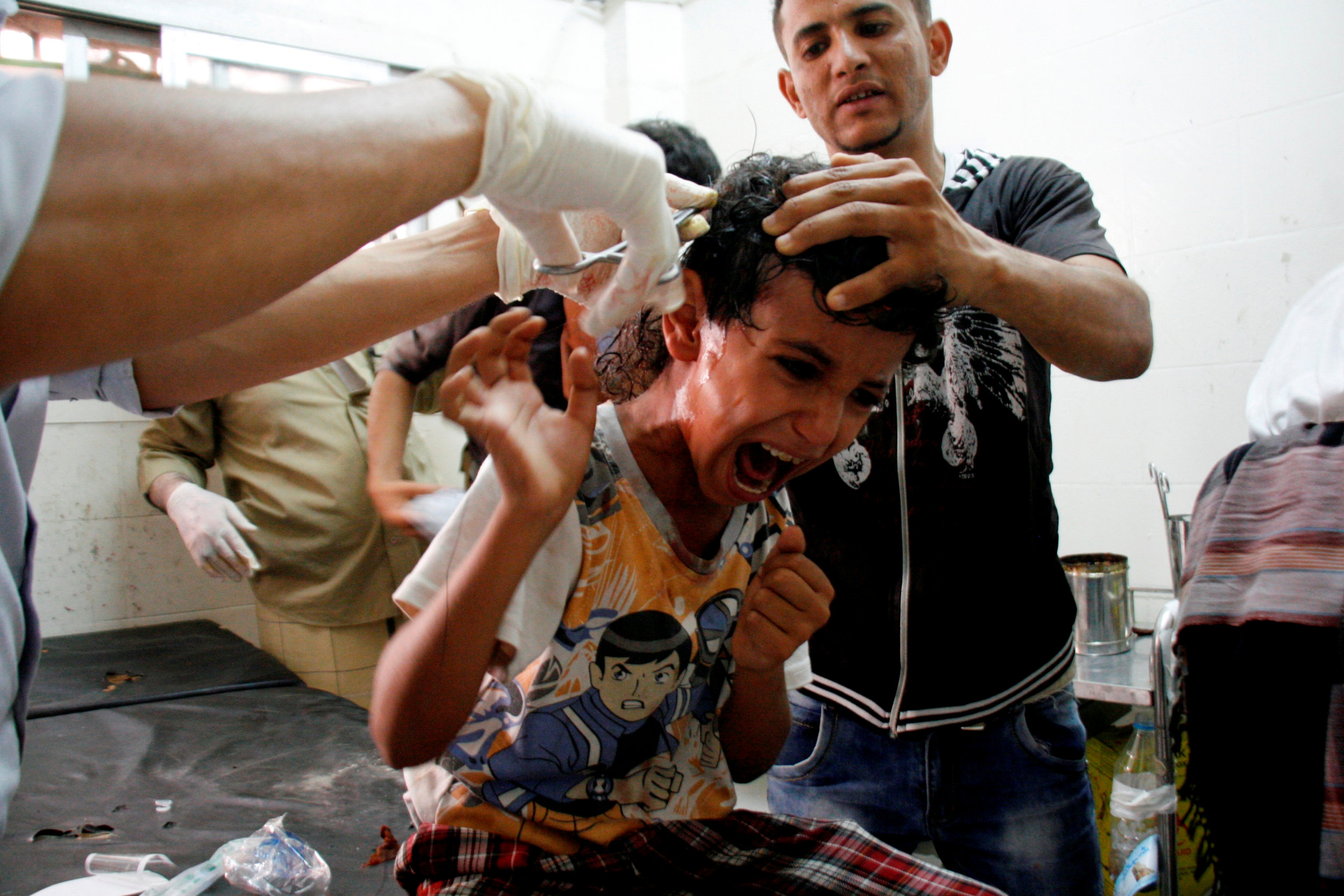 طفل مصاب فى تعز اليمنية