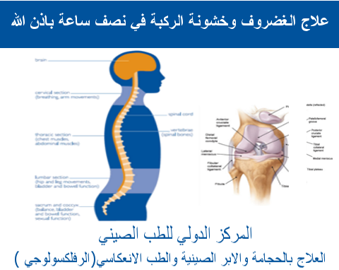 1 – يدعي علاج الغضروف