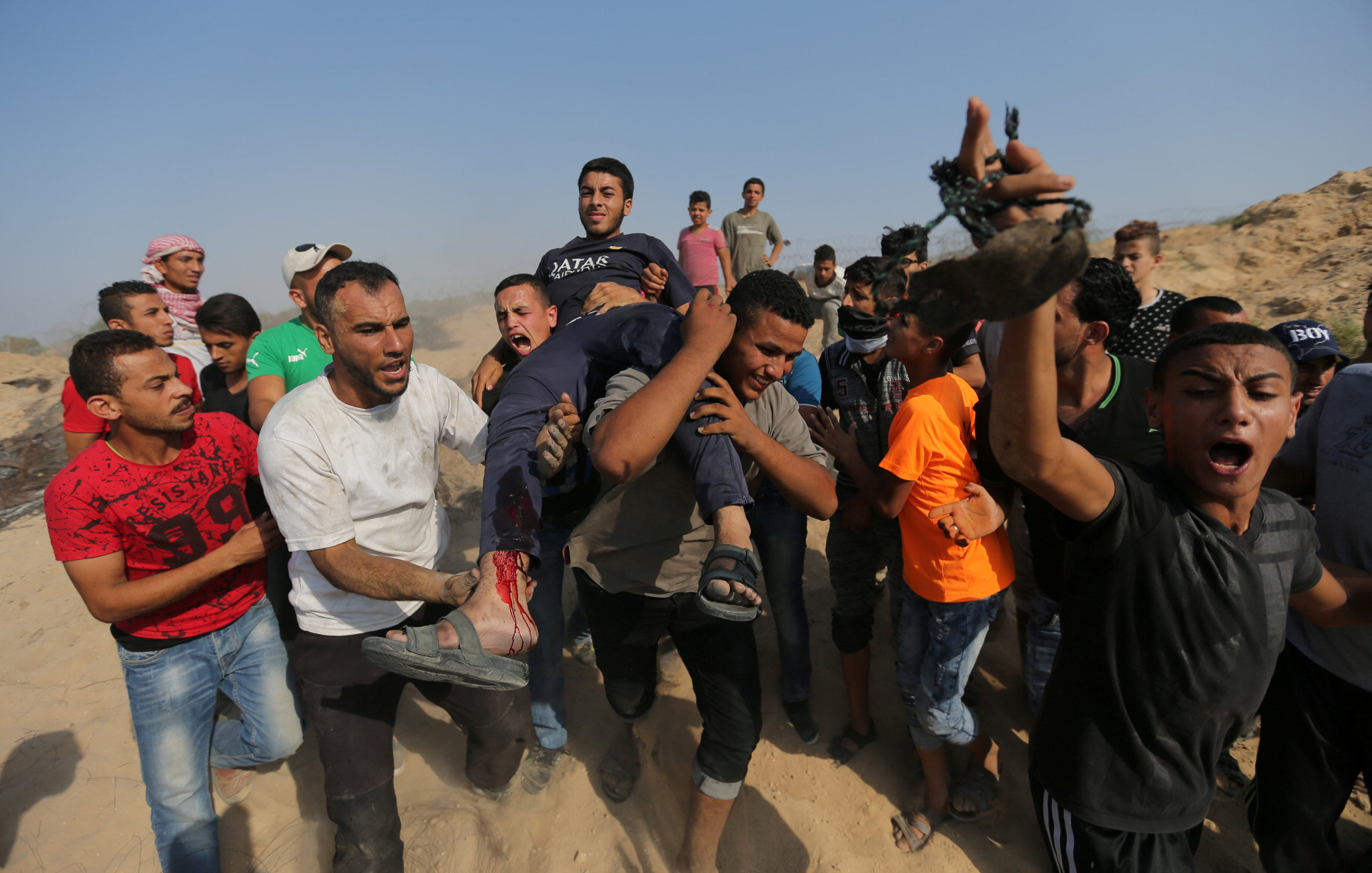 الفلسطينيون يحملون أحد الشباب المصاب برصاص الاحتلال
