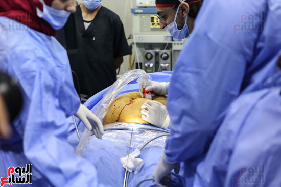 عملية جراحية لنقل دم لجنين داخل الرحم (3)