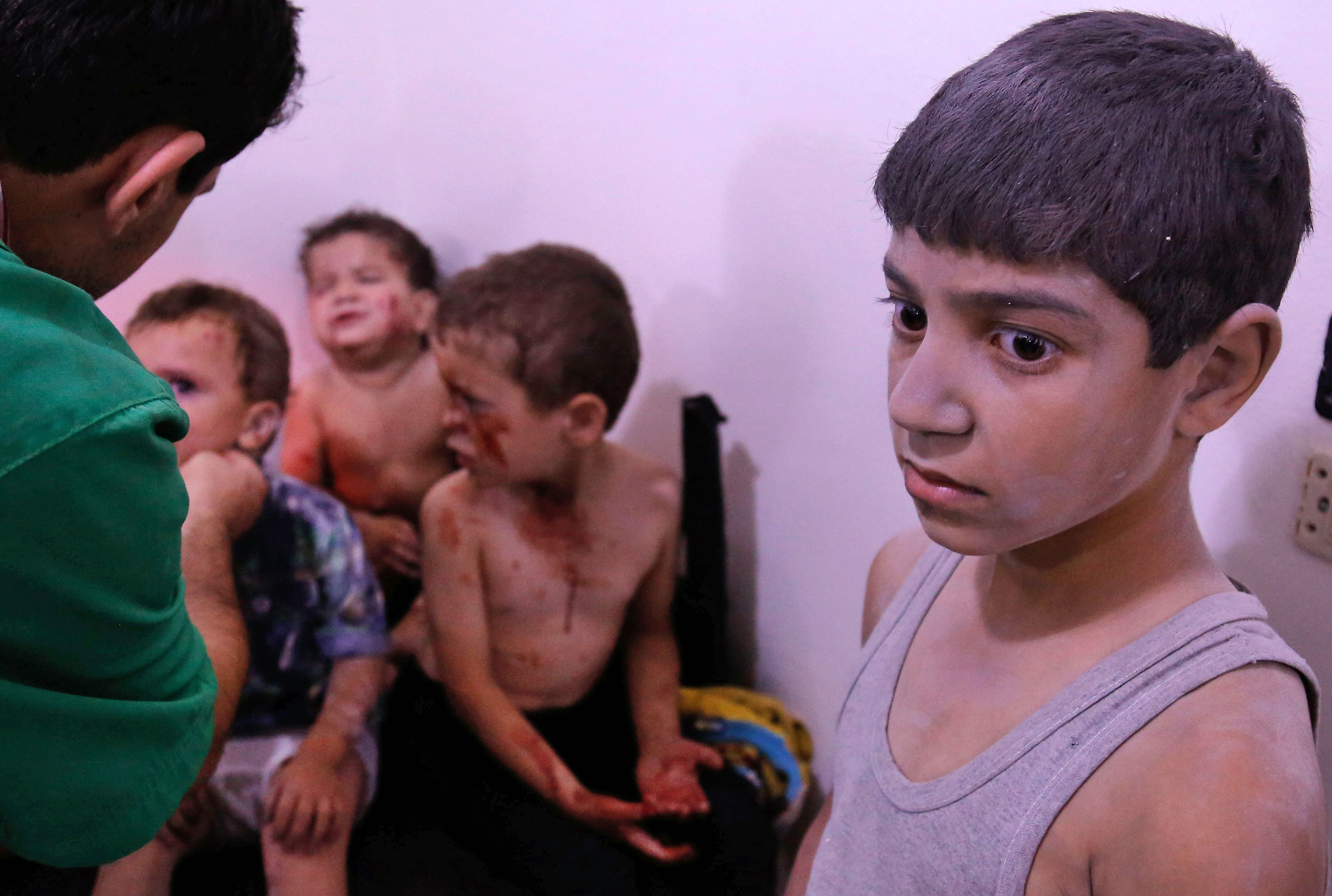 أطفال سوريا مصابين
