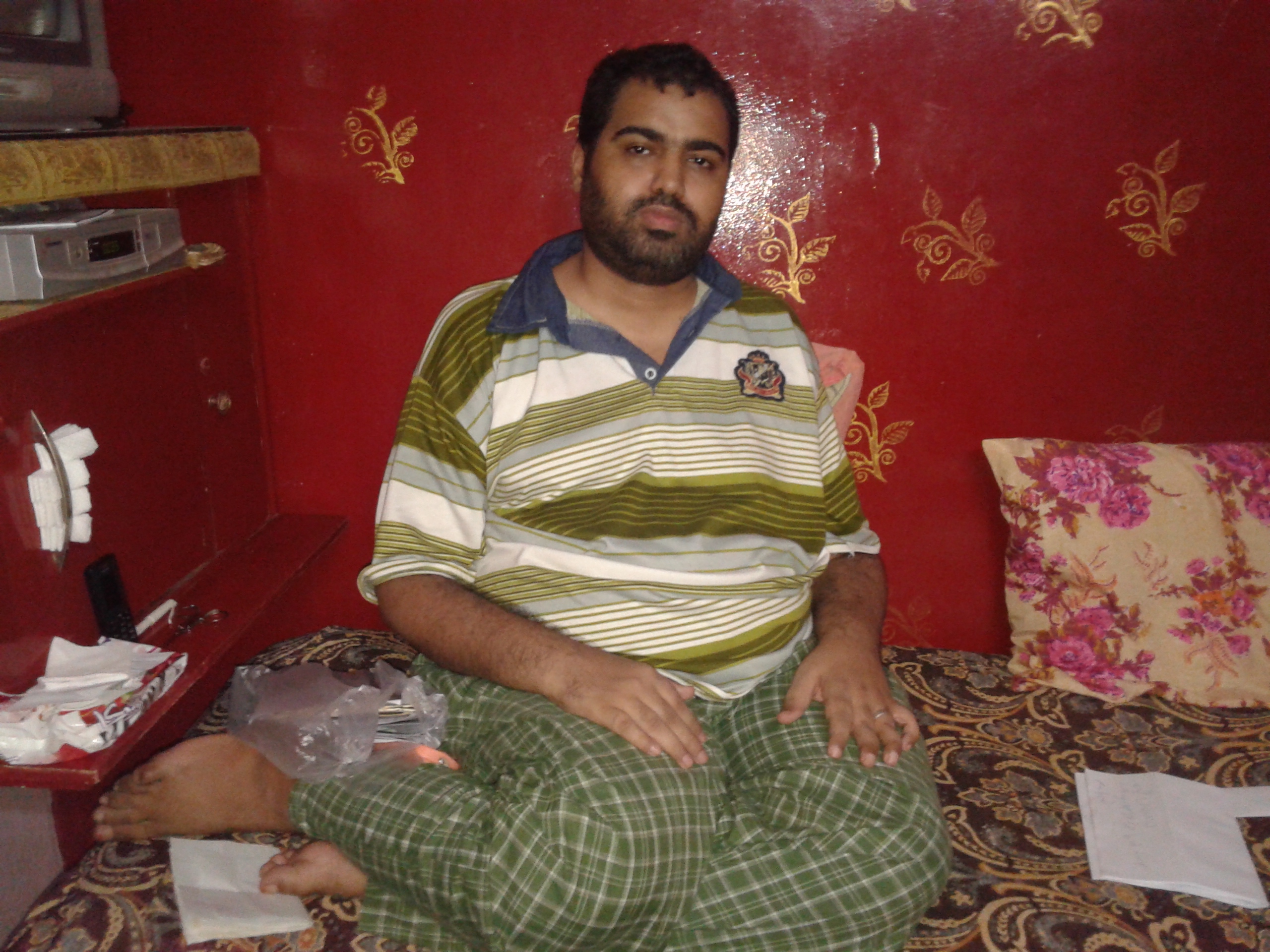 أحمد أصيب بالشلل ويحتاج كرسى بالكهرباء  (3)