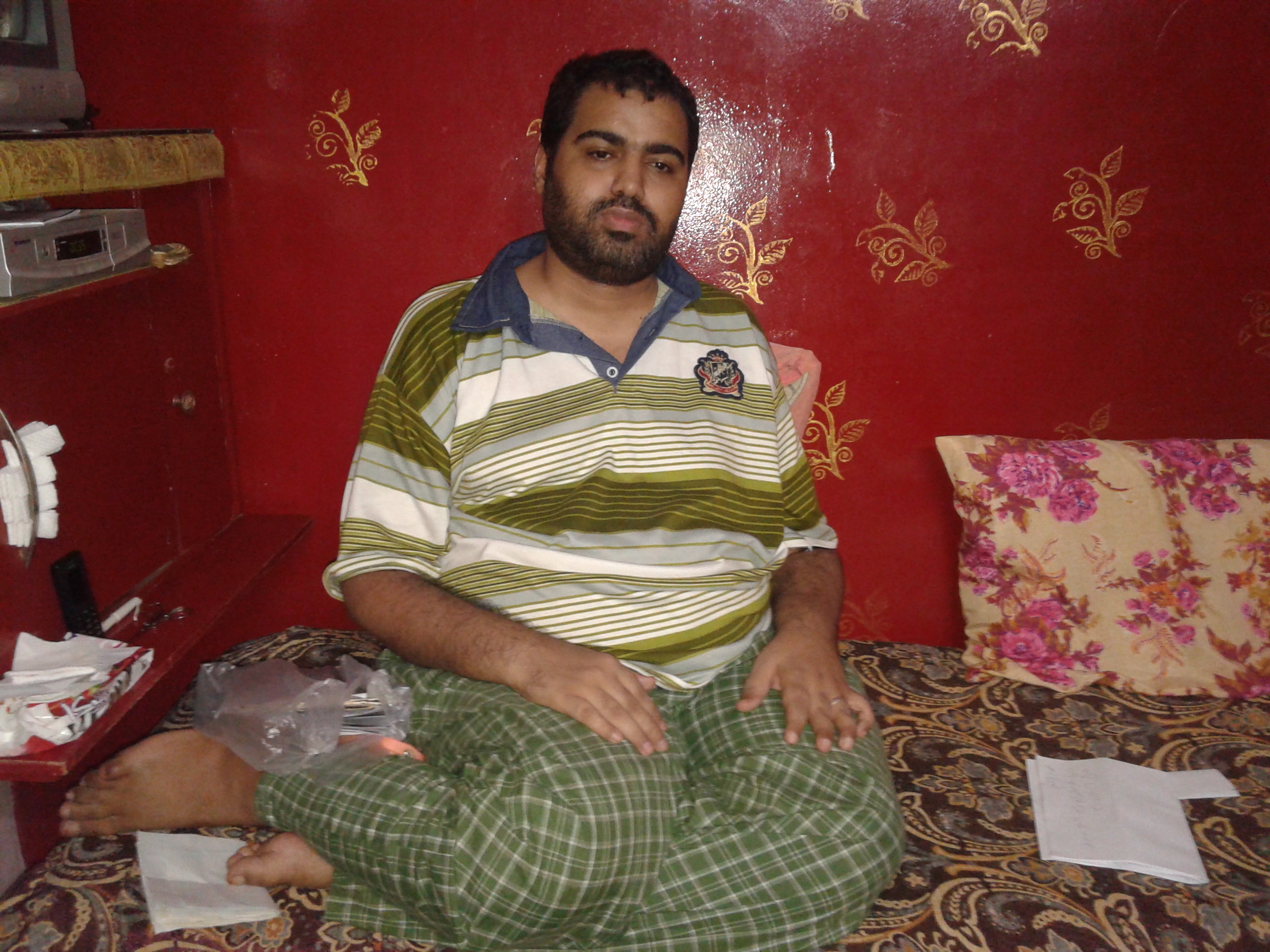 أحمد أصيب بالشلل ويحتاج كرسى بالكهرباء  (4)