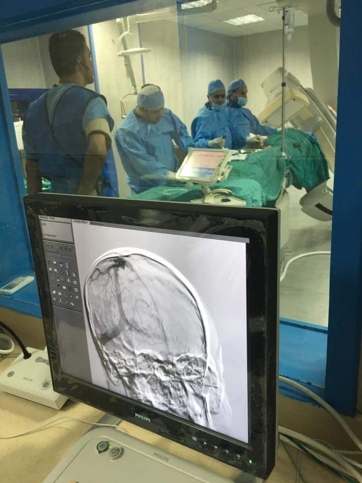 إجراء عملية قسطرة تشخيصية للمخ بمستشفى المنصورة العام الجديد (2)