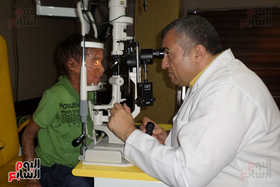 الدكتور اسامة يفحص عيون الطفل